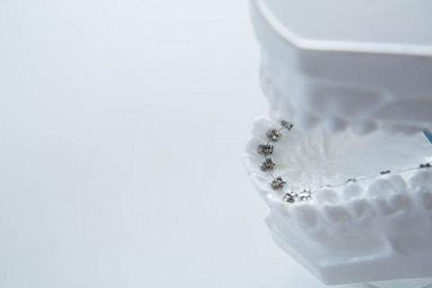 Tratamento Ortodontico