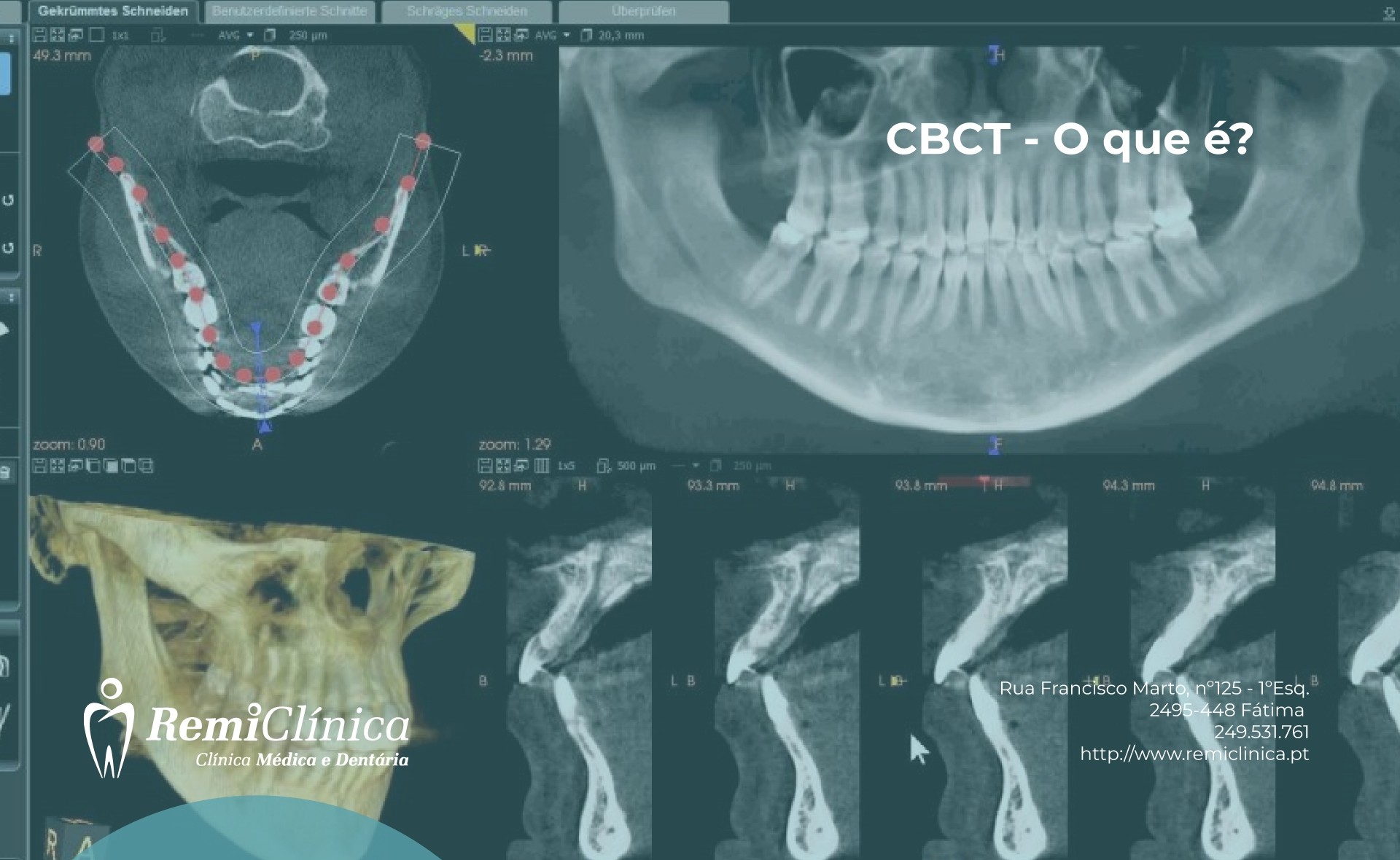 Página Cedimagem Diagnósticos - Tomografia do Maxilar e