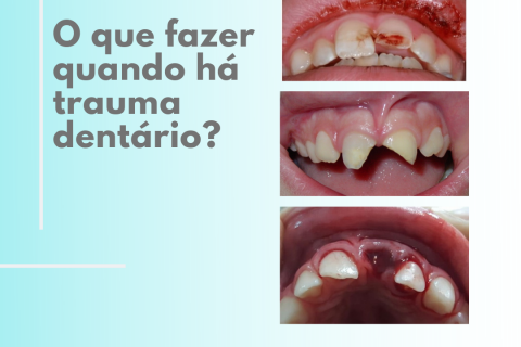 O que fazer quando h trauma dentrio?