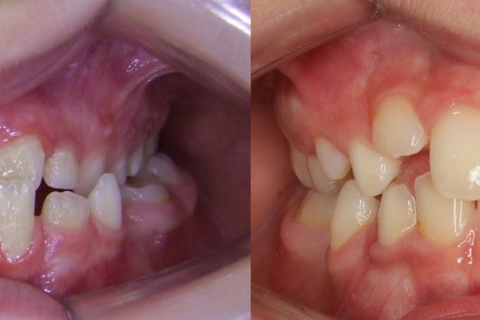 ortopediatria facial