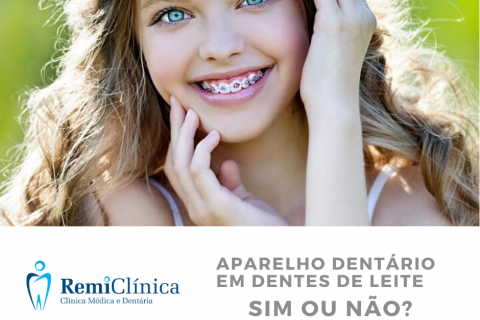 Aparelho dentrio em dentes de leite. 