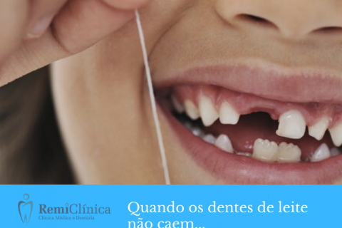 Quando os dentes de leite no caem