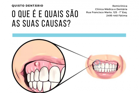 Quisto dentrio