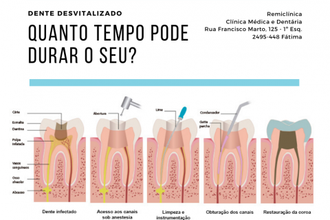 Dente desvitalizado