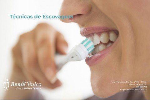 T[ecnica de escovagem