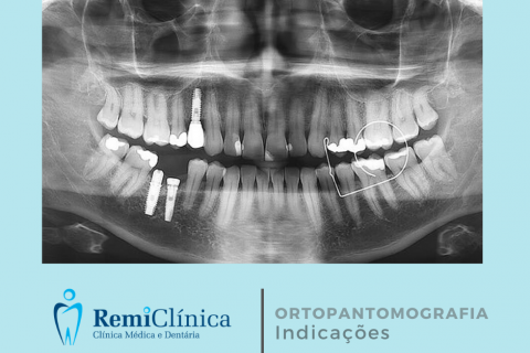 Ortopantomografia