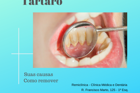 Trtaro - Qual a sua causa? Como remover?