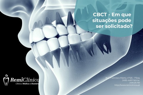 CBCT - casos